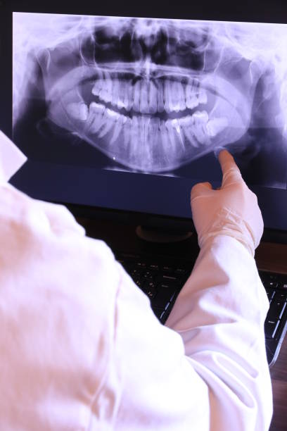 Best Emergency Dental Care for Broken or Chipped Teeth in West Kittanning, PA